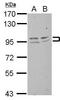 Fragile X mental retardation syndrome-related protein 2 antibody, GTX109465, GeneTex, Western Blot image 