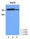 PFKM antibody, LS-C175824, Lifespan Biosciences, Western Blot image 