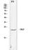 Chemokine Like Factor antibody, STJ97683, St John