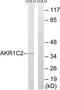 Aldo-keto reductase family 1 member C2 antibody, TA313748, Origene, Western Blot image 