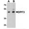 Double PHD Fingers 3 antibody, MBS153706, MyBioSource, Western Blot image 