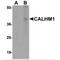 Calcium Homeostasis Modulator 1 antibody, MBS151258, MyBioSource, Western Blot image 