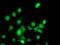 Complement C1s subcomponent antibody, LS-C173718, Lifespan Biosciences, Immunofluorescence image 
