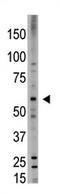 Bone Morphogenetic Protein 6 antibody, AP11667PU-N, Origene, Western Blot image 