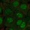 Chromosome 10 Open Reading Frame 67 antibody, NBP2-55273, Novus Biologicals, Immunofluorescence image 