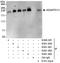 ADAMTS13 antibody, A301-003A, Bethyl Labs, Western Blot image 