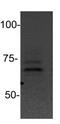Protein Inhibitor Of Activated STAT 2 antibody, NBP1-52022, Novus Biologicals, Western Blot image 