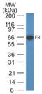 Estrogen Receptor 1 antibody, AM32844PU-S, Origene, Western Blot image 