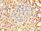 Lysyl Oxidase antibody, LS-C285766, Lifespan Biosciences, Immunohistochemistry paraffin image 