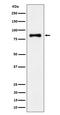 Aldehyde Dehydrogenase 16 Family Member A1 antibody, M14478, Boster Biological Technology, Western Blot image 