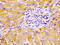 Cytochrome P450 Family 2 Subfamily B Member 6 antibody, LS-C669977, Lifespan Biosciences, Immunohistochemistry paraffin image 