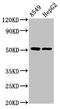 Protoporphyrinogen Oxidase antibody, CSB-PA018502LA01HU, Cusabio, Western Blot image 