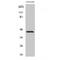 Abhydrolase Domain Containing 12 antibody, LS-C381853, Lifespan Biosciences, Western Blot image 