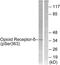 Opioid Receptor Delta 1 antibody, PA5-38252, Invitrogen Antibodies, Western Blot image 