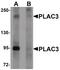 Pappalysin 2 antibody, PA5-21046, Invitrogen Antibodies, Western Blot image 