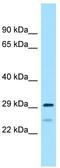 Ribosomal Protein S4 Y-Linked 2 antibody, TA334366, Origene, Western Blot image 