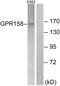 Probable G-protein coupled receptor 158 antibody, GTX87693, GeneTex, Western Blot image 