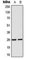 NK2 Homeobox 6 antibody, orb224142, Biorbyt, Western Blot image 