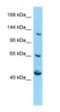 Calcium Voltage-Gated Channel Auxiliary Subunit Alpha2delta 4 antibody, NBP1-98469, Novus Biologicals, Western Blot image 