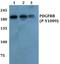 Nucleoporin 155 antibody, A06391-1, Boster Biological Technology, Western Blot image 