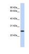 Biliverdin Reductase B antibody, NBP1-53068, Novus Biologicals, Western Blot image 