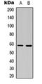 Cathepsin Z antibody, orb256483, Biorbyt, Western Blot image 