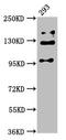 RAB3 GTPase Activating Non-Catalytic Protein Subunit 2 antibody, LS-C675140, Lifespan Biosciences, Western Blot image 