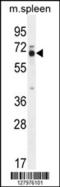 Leiomodin 2 antibody, 55-148, ProSci, Western Blot image 
