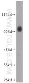 Dystrophin antibody, 12715-1-AP, Proteintech Group, Western Blot image 