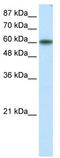 Kruppel Like Factor 11 antibody, TA329657, Origene, Western Blot image 