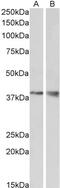 GGCX antibody, 42-100, ProSci, Western Blot image 
