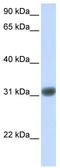 Orthodenticle Homeobox 2 antibody, TA329270, Origene, Western Blot image 