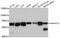 SWI/SNF Related, Matrix Associated, Actin Dependent Regulator Of Chromatin, Subfamily D, Member 2 antibody, A12104, ABclonal Technology, Western Blot image 