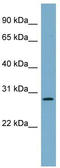DnaJ Heat Shock Protein Family (Hsp40) Member B9 antibody, TA341906, Origene, Western Blot image 