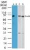 SKI Like Proto-Oncogene antibody, TA337044, Origene, Western Blot image 