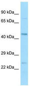 Beaded Filament Structural Protein 2 antibody, TA338229, Origene, Western Blot image 