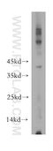 Vasohibin 2 antibody, 13303-1-AP, Proteintech Group, Western Blot image 