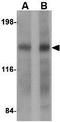 Dispatched RND Transporter Family Member 2 antibody, GTX31364, GeneTex, Western Blot image 