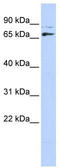 Homeobox protein DLX-4 antibody, TA329351, Origene, Western Blot image 