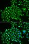 Alkaline Phosphatase, Placental antibody, orb247385, Biorbyt, Immunofluorescence image 