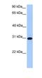 CKLF Like MARVEL Transmembrane Domain Containing 8 antibody, orb330709, Biorbyt, Western Blot image 