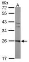 Coiled-Coil Domain Containing 90B antibody, PA5-31579, Invitrogen Antibodies, Western Blot image 