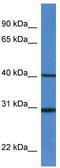 H13 antibody, TA339562, Origene, Western Blot image 