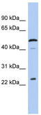 Leucine Rich Adaptor Protein 1 antibody, TA336099, Origene, Western Blot image 