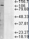 Lysosomal Associated Membrane Protein 1 antibody, TA326567, Origene, Western Blot image 