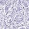 Ubiquitin Like 3 antibody, HPA058781, Atlas Antibodies, Immunohistochemistry paraffin image 