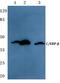 CCAAT Enhancer Binding Protein Beta antibody, AP06676PU-N, Origene, Western Blot image 