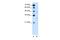 Solute Carrier Family 36 Member 3 antibody, A14401, Boster Biological Technology, Western Blot image 