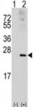 Rac Family Small GTPase 1 antibody, abx033488, Abbexa, Western Blot image 