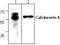 Serine/threonine-protein phosphatase 2B catalytic subunit beta isoform antibody, GTX59619, GeneTex, Western Blot image 